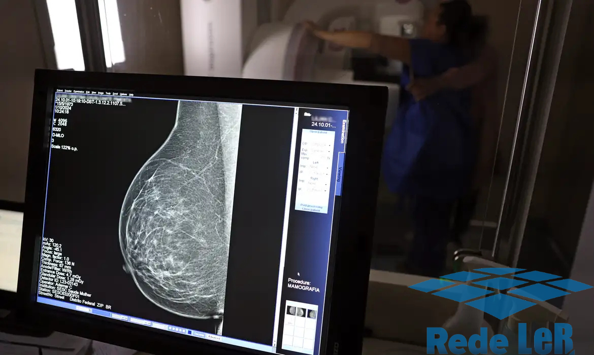 Leia mais sobre o artigo Cerca de 77 mil mulheres aguardam mamografia pelo SUS